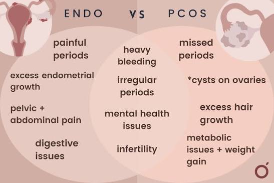 PCOS